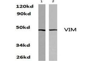 Image no. 1 for anti-Vimentin (VIM) antibody (ABIN271977) (Vimentin 抗体)