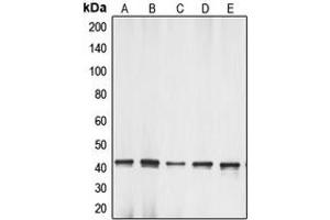 Western blot analysis of Gamma-actin-1 expression in HeLa (A), Raw264. (gamma-Actin-1 (C-Term) 抗体)