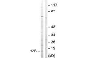 Western blot analysis of extracts from Jurkat cells, treated with UV 15', using Histone H2B (Ab-14) Antibody. (Histone H2B 抗体  (AA 1-50))