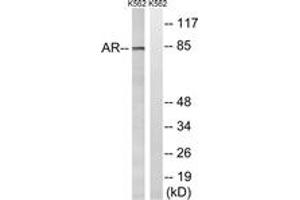 Western Blotting (WB) image for anti-Androgen Receptor (AR) (AA 331-380) antibody (ABIN2889124) (Androgen Receptor 抗体  (AA 331-380))