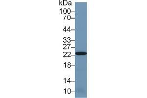 Western Blot; Sample: Mouse Kidney lysate; Primary Ab: 1µg/ml Rabbit Anti-Human PRDX2 Antibody Second Ab: 0. (Peroxiredoxin 2 抗体  (AA 6-164))