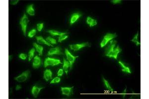 Immunofluorescence (IF) image for anti-Eukaryotic Translation Elongation Factor 1 gamma (EEF1G) (AA 1-437) antibody (ABIN560696)