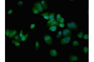 Immunofluorescent analysis of MCF-7 cells using ABIN7148671 at dilution of 1:100 and Alexa Fluor 488-congugated AffiniPure Goat Anti-Rabbit IgG(H+L) (CBP 抗体  (AA 2217-2442))