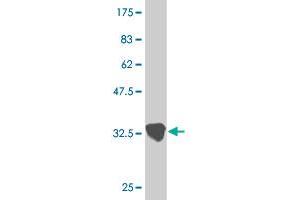 Western Blot detection against Immunogen (33. (ZIC2 抗体  (AA 151-216))