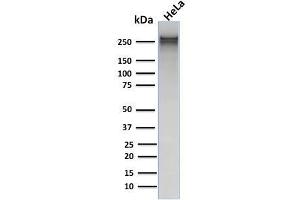 Western Blotting (WB) image for anti-Spectrin alpha 1, Erythrocytic (SPTA1) (AA 356-475) antibody (ABIN6940645)