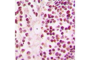 Immunohistochemical analysis of CBP staining in human tonsil formalin fixed paraffin embedded tissue section. (CBP 抗体  (C-Term))