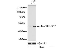 Western blot analysis of extracts of various cell lines using Phospho-MAP2K1(S217) Polyclonal Antibody at dilution of 1:1000. (MEK1 抗体  (pSer217))