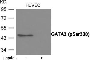 Western blot analysis of extracts from HUVEC cells using GATA3 (Phospho-Ser308) Antibody. (GATA3 抗体  (pSer308))