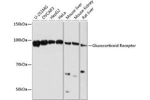 Western blot analysis of extracts of various cell lines, using Glucocorticoid Receptor antibody (ABIN7269016) at 1:1000 dilution. (Glucocorticoid Receptor 抗体)