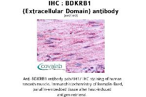 Image no. 1 for anti-Bradykinin Receptor B1 (BDKRB1) (2nd Extracellular Domain) antibody (ABIN1732269) (BDKRB1 抗体  (2nd Extracellular Domain))