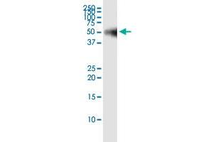 Immunoprecipitation of PPM1F transfected lysate using rabbit polyclonal anti-PPM1F and Protein A Magnetic Bead ( U0007 ), and immunoblotted with mouse purified polyclonal anti-PPM1F. (PPM1F (人) IP-WB Antibody Pair)