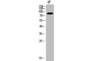 Western Blot analysis of KB cells using Phospho-PI 3-kinase p85α (Y607) Polyclonal Antibody (PIK3R1 抗体  (pTyr607))