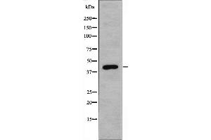 Western blot analysis of extracts from 293 cells using CBX6 antibody. (CBX6 抗体  (N-Term))