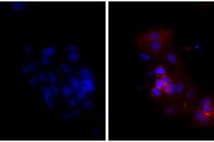 Human epithelial carcinoma cell line HEp-2 was stained with Mouse Anti-Human CD44-UNLB and DAPI. (山羊 anti-小鼠 IgG Antibody (Texas Red (TR)))
