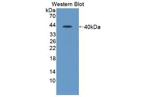 Western blot analysis of recombinant Human SDF1. (CXCL12 抗体)