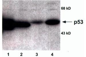 Each lane contains 50µg of total cellular protein separated by 10% SDS-PAGE. (p53 抗体)