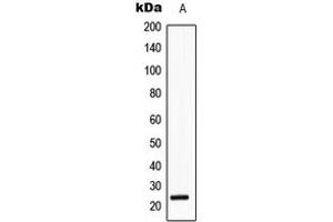 Western blot analysis of SRY expression in HeLa (A) whole cell lysates. (SRY 抗体  (Center))