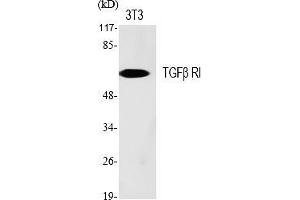 Western Blot analysis of various cells using TGFβ RI Polyclonal Antibody diluted at 1:500. (TGFBR1 抗体)