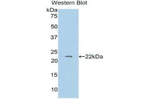 Western Blotting (WB) image for anti-Protein S (PROS) (AA 301-476) antibody (ABIN1175271) (PROS1 抗体  (AA 301-476))