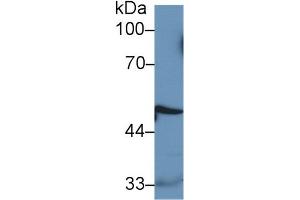 Western Blotting (WB) image for Cathepsin D (CTSD) ELISA Kit (ABIN6574268)