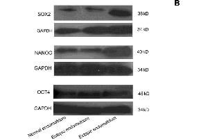 Western Blotting (WB) image for anti-Glyceraldehyde-3-Phosphate Dehydrogenase (GAPDH) (AA 1-335) antibody (ABIN678458)