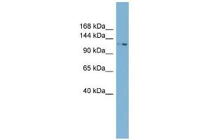 TTC17 antibody used at 1 ug/ml to detect target protein. (TTC17 抗体  (N-Term))