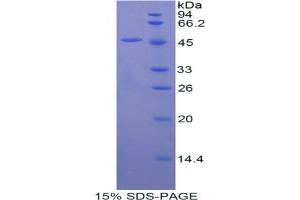 SDS-PAGE analysis of Mouse FGF10 Protein. (FGF10 蛋白)