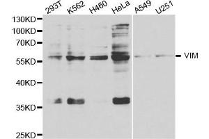Western Blotting (WB) image for anti-Vimentin (VIM) antibody (ABIN1875329) (Vimentin 抗体)