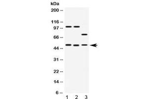 Western blot testing of 1) rat brain, 2) mouse brain and 3) human HeLa lysate with AZIN2 antibody at 0. (ADC 抗体)