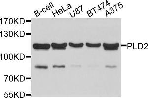 Western blot analysis of extracts of various cell lines, using PLD2 antibody (ABIN6003877) at 1/1000 dilution. (Phospholipase D2 抗体)