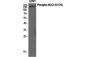 Western Blotting (WB) image for anti-Nitric Oxide Synthase 3 (Endothelial Cell) (NOS3) (pSer1177) antibody (ABIN5961402) (ENOS 抗体  (pSer1177))