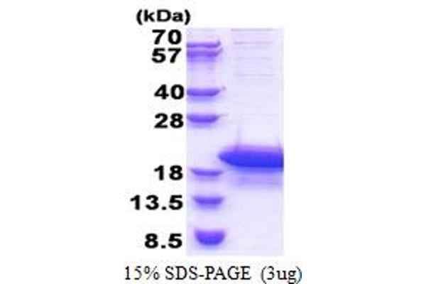 ARPP19 Protein (AA 1-112) (His tag)