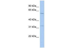 FLJ20628 antibody used at 1 ug/ml to detect target protein. (FLJ20628 (N-Term) 抗体)