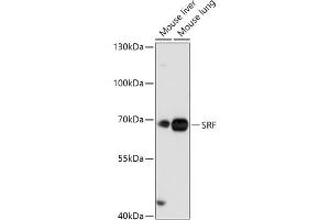 Western blot analysis of extracts of various cell lines, using SRF antibody (ABIN7270257) at 1:1000 dilution. (SRF 抗体  (AA 1-280))