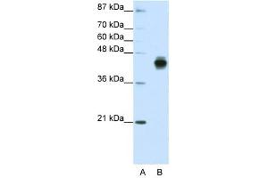 Cytokeratin 18 antibody used at 1. (Cytokeratin 18 抗体  (C-Term))