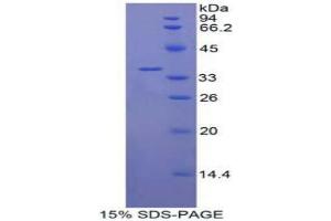 SDS-PAGE analysis of Human IL22R Protein. (IL22R 蛋白)