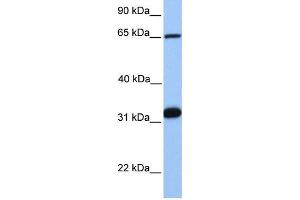 WB Suggested Anti-SF1  Antibody Titration: 0. (Splicing Factor 1 抗体  (C-Term))