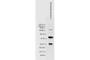 Western Blotting (WB) image for anti-Heat Shock 22kDa Protein 8 (HSPB8) antibody (ABIN6656214)