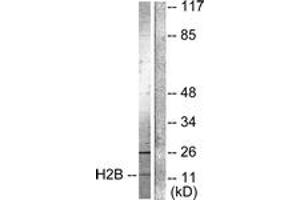 Western blot analysis of extracts from Raw264. (Histone H2B 抗体  (acLys15))