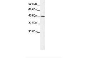 Image no. 1 for anti-Y Box Binding Protein 1 (YBX1) (AA 236-285) antibody (ABIN6735879) (YBX1 抗体  (AA 236-285))