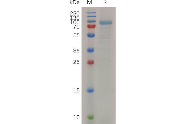 MMP13 Protein (AA 20-148) (Fc Tag)