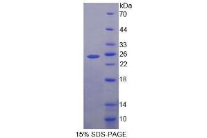 SDS-PAGE (SDS) image for Enhancer of Zeste Homolog 1 (EZH1) (AA 559-747) protein (His tag) (ABIN4990868) (EZH1 Protein (AA 559-747) (His tag))