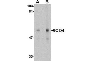 Western Blotting (WB) image for anti-CD4 (CD4) antibody (ABIN1031727) (CD4 抗体)