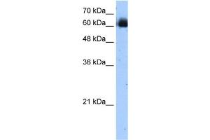 WB Suggested Anti-RELB Antibody Titration:  1. (RELB 抗体  (C-Term))