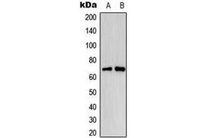 Western blot analysis of Estrogen Receptor alpha (pS118) expression in MCF7 EGF-treated (A), HeLa EGF-treated (B) whole cell lysates. (Estrogen Receptor alpha 抗体  (pSer118))