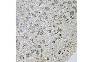 Immunohistochemistry (IHC) image for anti-Androgen Receptor (AR) antibody (ABIN1871059)