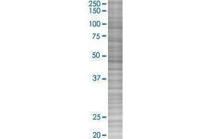 NSDHL transfected lysate. (NSDHL 293T Cell Transient Overexpression Lysate(Denatured))