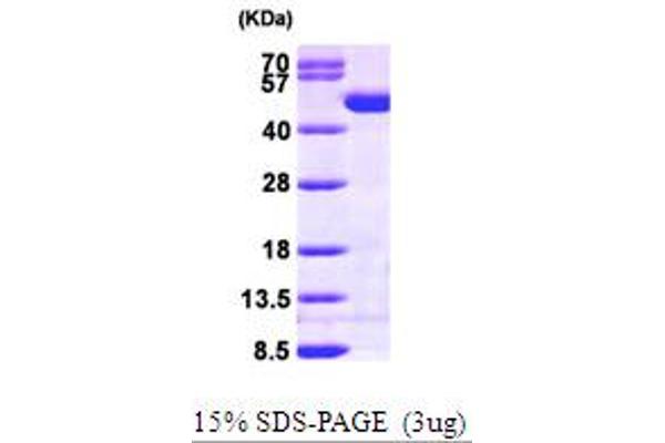 CKB Protein (AA 1-381) (His tag)