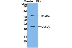 Detection of Recombinant SPINK5, Human using Polyclonal Antibody to Serine Peptidase Inhibitor Kazal Type 5 (SPINK5) (SPINK5 抗体  (AA 699-976))