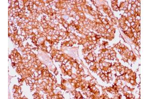 Immunohistochemistry (IHC) image for anti-Epithelial Cell Adhesion Molecule (EPCAM) antibody (ABIN6939995)